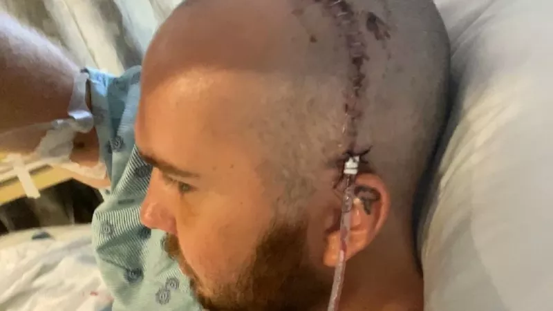 Image: A look at Michael Driscoll's ear-to-ear incision following facial-reconstruction surgery necessitated by the wound he suffered during the 2020 George Floyd protests in Denver.