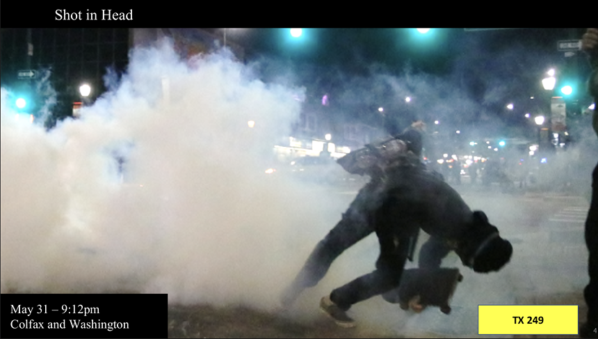 George Floyd protester Zackary Packard moments after being shot in the head with a beanbag round fired by police from a shotgun.