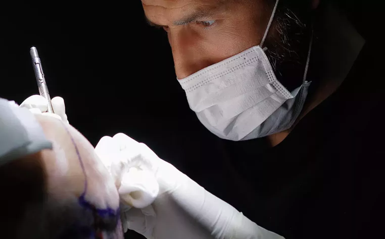 Hair Transplant Turkey Package 2024: Affordability and Renewed Confidence - Vimarsana News